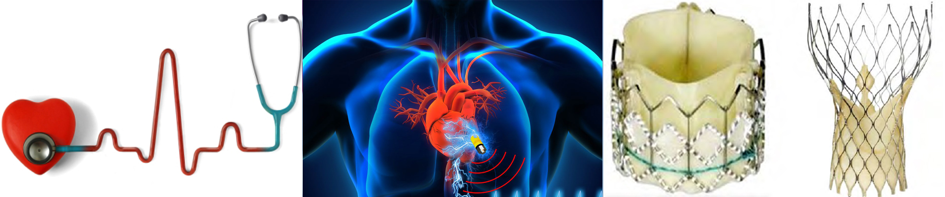 Best Cardiologist in Delhi